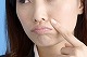 たるみが原因？ほうれい線とたるみの関係とはのアイキャッチ画像