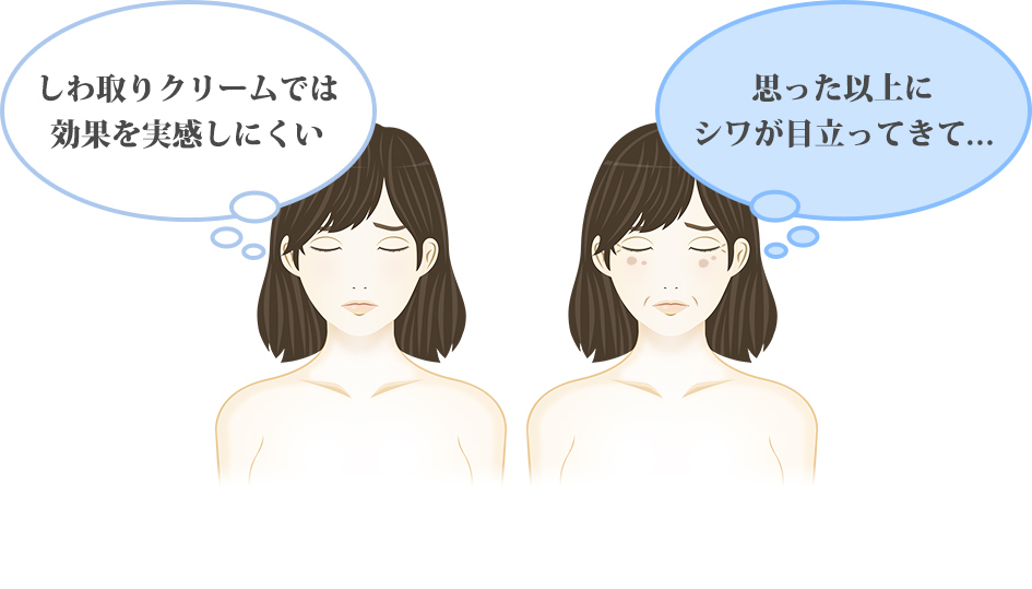 しわ取りクリームでは効果を実感しにくい 思った以上にシワが目立ってきて・・・